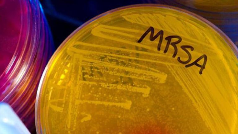 mrsa