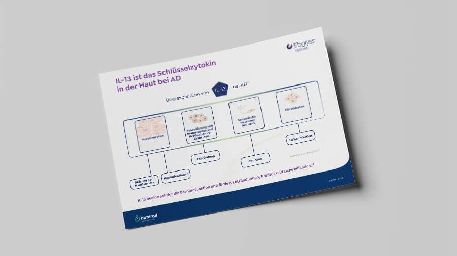 Ebglyss Mockup Vorschau IL 13