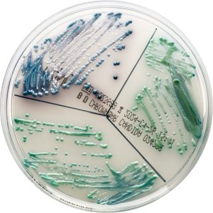 Dermatomykosen und infizierte Ekzeme Hefepilze