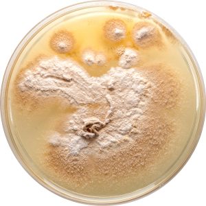Dermatomykosen und infizierte Ekzeme Schimmelpilze