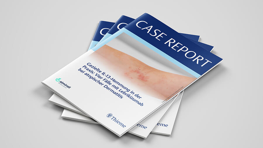 EBGLYSS MckUp Thieme Case Report Tiny